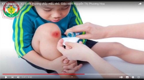 GD kỹ năng   Bé làm gì khi bị chảy máu  - Giáo viên: Nguyễn Thị Phương Hoa